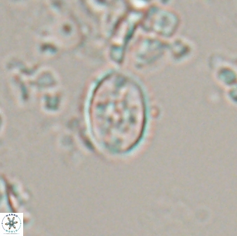 Eiffellithus monechiae 17425