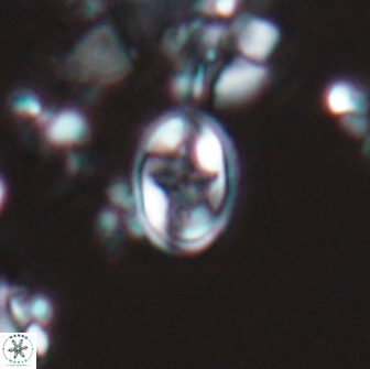 Eiffellithus monechiae 17426