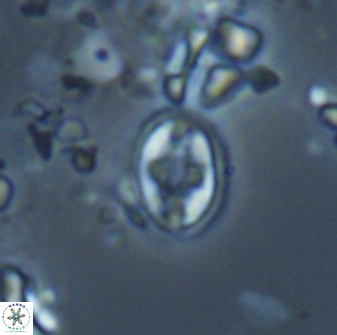 Eiffellithus monechiae 17422