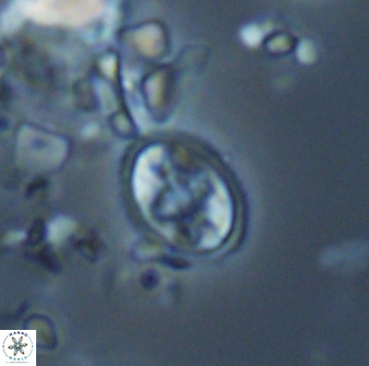 Eiffellithus monechiae 17423