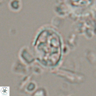 Eiffellithus monechiae 17438