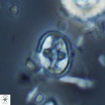 Eiffellithus monechiae 17439