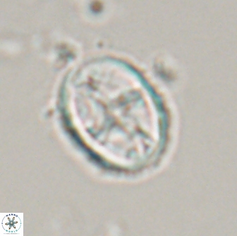 Eiffellithus monechiae 17449