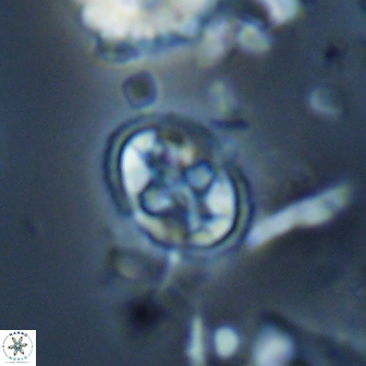 Eiffellithus monechiae 17442
