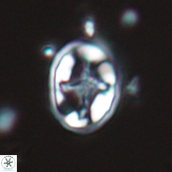 Eiffellithus monechiae 17443
