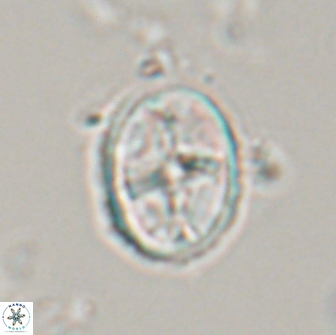 Eiffellithus monechiae 17450