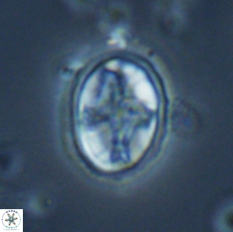 Eiffellithus monechiae 17451
