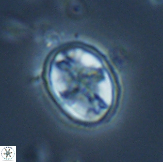 Eiffellithus monechiae 17452