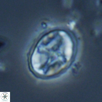 Eiffellithus monechiae 17453