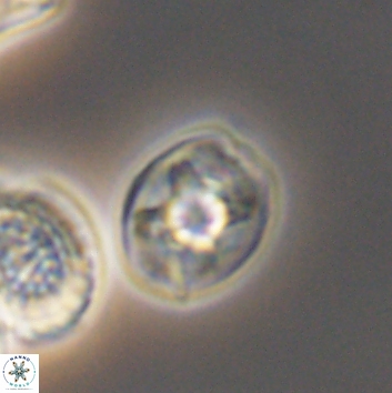 Eiffellithus parallelus 12080
