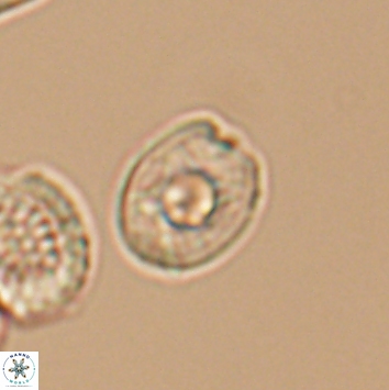 Eiffellithus parallelus 12081