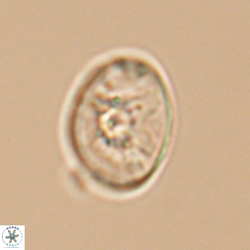 Eiffellithus parallelus 12097