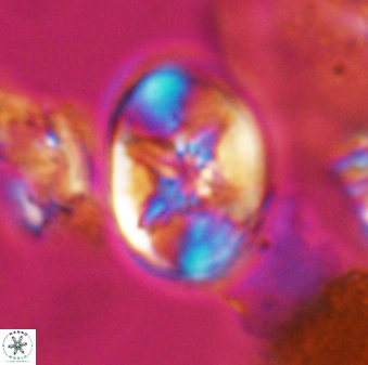 Eiffellithus parallellus 10062