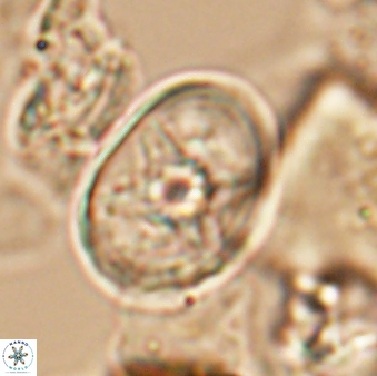 Eiffellithus parallellus 10065