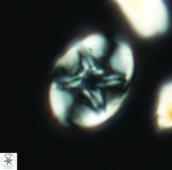 Eiffellithus parallellus 3125