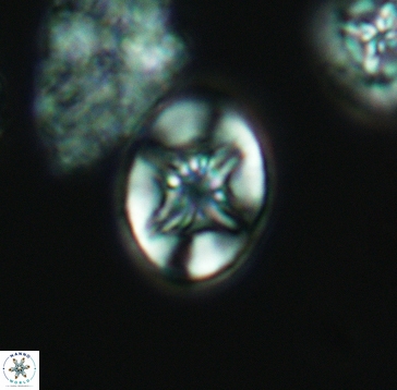 Eiffellithus parallellus 3257