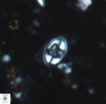 Eiffellithus parvus 981