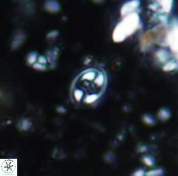 Eiffellithus parvus 991