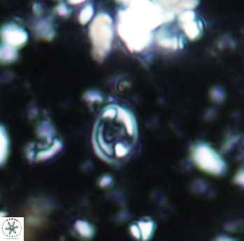 Eiffellithus parvus 994