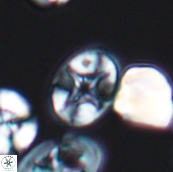 Eiffellithus perchnielseniae 8579