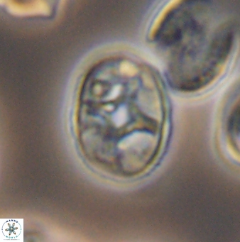 Eiffellithus perchnielseniae 8704