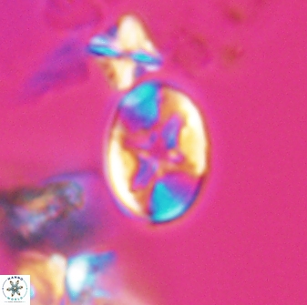 Eiffellithus phantasma 10025
