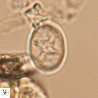 Eiffellithus phantasma 10028