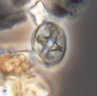 Eiffellithus phantasma 10029