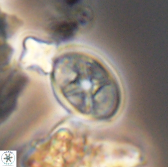 Eiffellithus phantasma 10030
