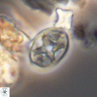 Eiffellithus phantasma 10031