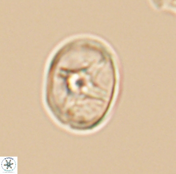 Eiffellithus phantasma 10110