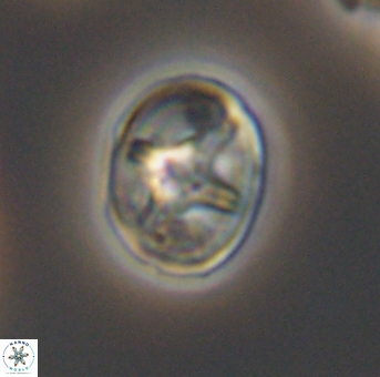 Eiffellithus phantasma 10111