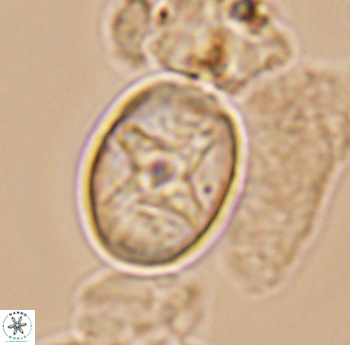 Eiffellithus phantasma 10174