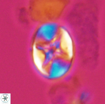 Eiffellithus phantasma 10179