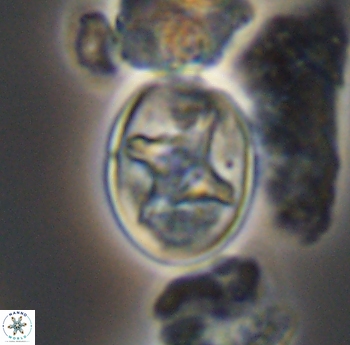 Eiffellithus phantasma 10172
