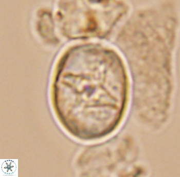 Eiffellithus phantasma 10173