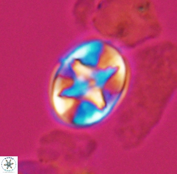 Eiffellithus phantasma 10181