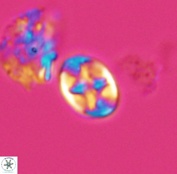 Eiffellithus phantasma 10226