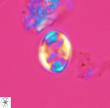 Eiffellithus phantasma 10228