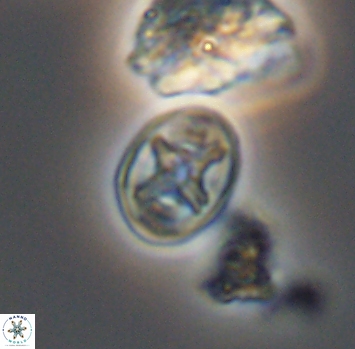 Eiffellithus phantasma 10232