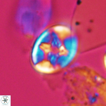 Eiffellithus phantasma 9849