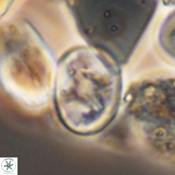Eiffellithus phantasma 9850