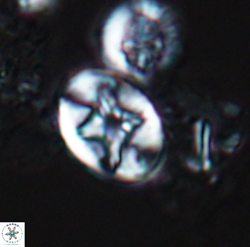 Eiffellithus phantasma 9879