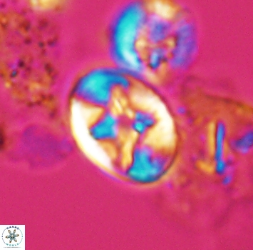 Eiffellithus phantasma 9880