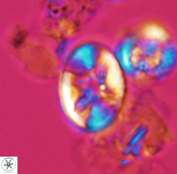 Eiffellithus phantasma 9882
