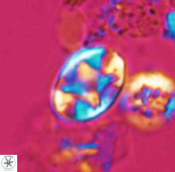 Eiffellithus phantasma 9884