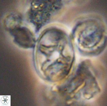 Eiffellithus phantasma 9885