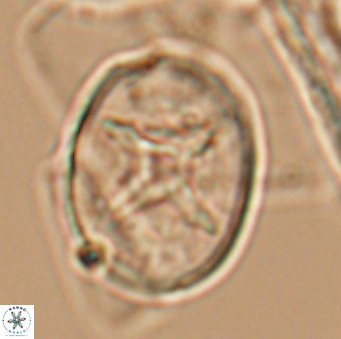 Eiffellithus turriseiffelii 10082