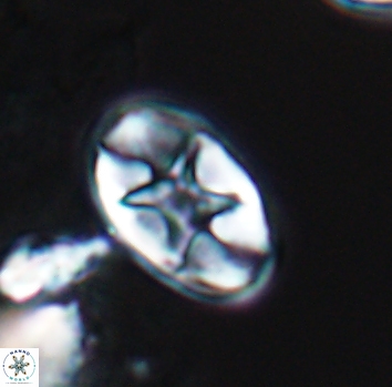 Eiffellithus turriseiffelii 10217