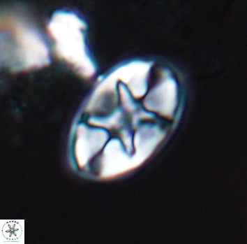 Eiffellithus turriseiffelii 10221